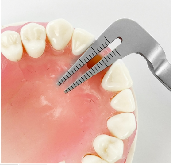 Power Implant Centering Guide – Set of 2