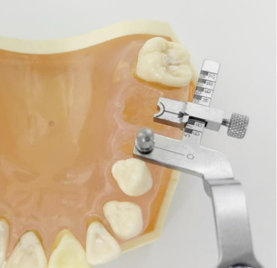 Power Implant Centering Guide – Set of 2